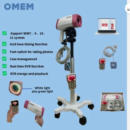 YDJ100D — Gynecological видео Colposcope/ЖК-дисплей 3, 5 дюйма, зеленый свет, диагностическое программное обеспечение и напольный кронштейн