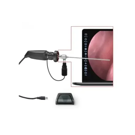 petsYN-602K-2 — Портативная USB-видеокамера Endoscope Видеопроцессор Endoscopy для ЛОР, анохоскопии