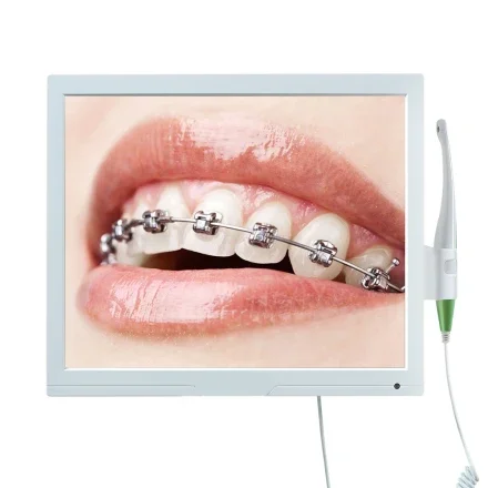 FM368C — Цифровая программа просмотра Mouth ( ) Мультимедийная модель Оральный цифровой просмотрщик Стоматологический цифровой просмотрщик