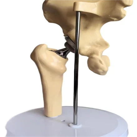 Artificial Сустав Artificial Hip сустав Hip артропластика Обучающие модели из пластика