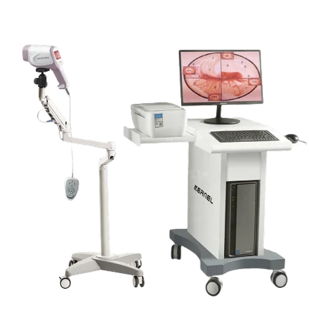 KN-2200 — Цифровой кольпоскоп видео Flexible Эндоскоп Imaging Система Целое диагностическое устройство