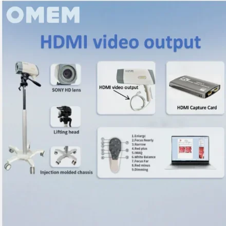 YDJ200A — Высокий Definition Цифровой Colposcope, вход HDMI, в комплекте с программным обеспечением для обработки изображений и напольной подставкой