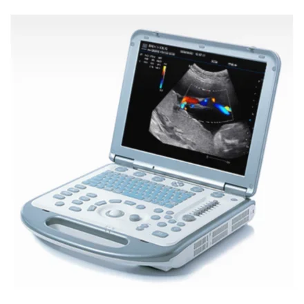 Mindray Doppler M5 — Портативная система цветного допплера Ультразвуковой аппарат Компактная портативная система цветного допплера