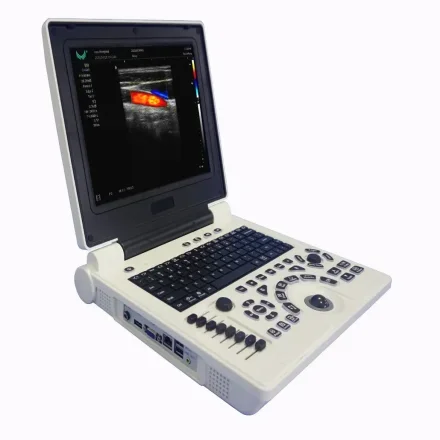 Портативная система цветной доплеровской ультразвуковой диагностики Laptop P/W DICOM Система визуализации на нескольких языках