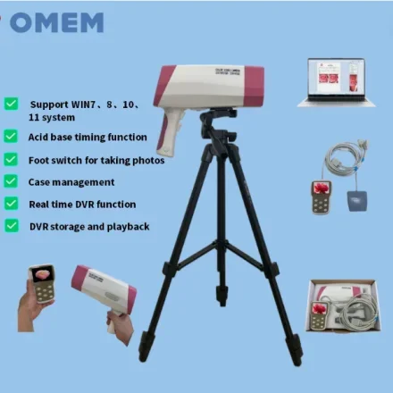 YDJ100D — Full Набор цифровых Colposcope/ЖК-экран, диагностическое программное обеспечение, штатив и 3, 5-дюймовый визуальный пульт дистанционного управления