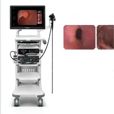 Hd электронная эндоскопическая система колоноскопии Медицинское оборудование Система видеоколоноскопии высокого разрешения Цифровая и расширенная коллекция колоноскопии с камерой