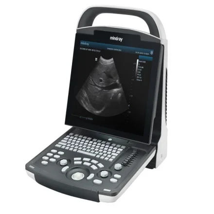 Mindray DP10 — Цифровая ультразвуковая диагностическая система визуализации Стандартная конфигурация ультразвука с одним датчиком, китайская версия