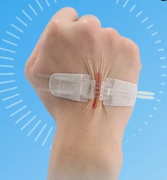 Одноразовый Устройство для закрытия ран на молнии Elastic Повязка на молнии Медицинская заплата от шрама