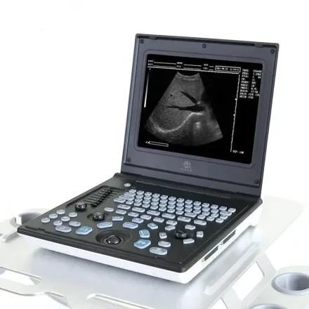 Laptop ультразвуковой сканер черно-белая ультразвуковая диагностическая система для использования в больнице