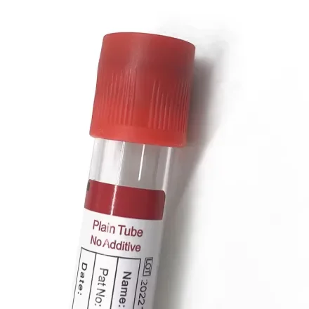 WG-DG-01 — Пробирка Pro-coagulation нестерильная Емкость пробирки для крови 1-5ML 13*75 мм Пластиковые одноразовые стерильные стеклянные вакуумные пробирки для сбора крови Vacutainer