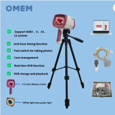 YDJ100C — 2. 5″ Ручная камера видео Colposcope, зеленый светодиод, с диагностическим программным обеспечением и подставкой для камеры