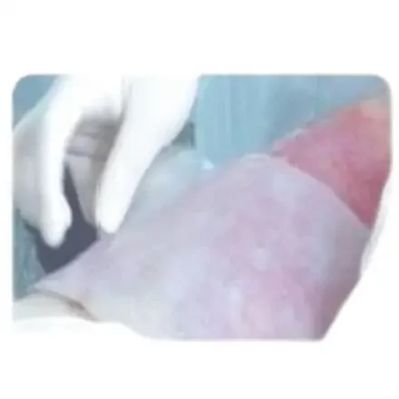 Медицинская повязка для ран Hydrogel HD-L, тип 12см×8см