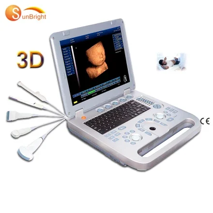 SUN-800D — Цифровой портативный ультразвуковой аппарат 3D с ультразвуковой системой эхографа и аксессуарами для эхокардиографии