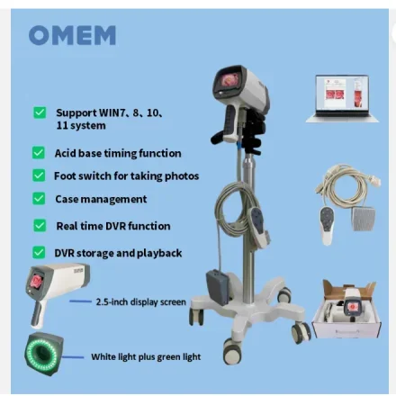 YDJ100C — Visual цифровой гинеколог Colposcope с зеленым светом, ЖК-экраном и диагностическим программным обеспечением, с передвижной напольной подставкой