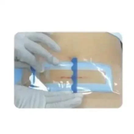Медицинская повязка раневая Hydrogel HD-M 8см×6см