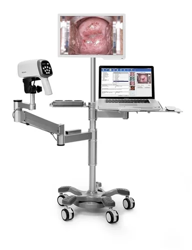 Edan C6A — Gynecological Colposcope — устройство для точного вагинального исследования и четкой визуализации