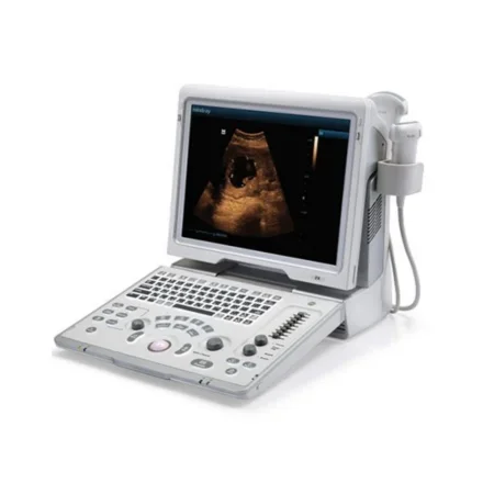 Mindray Doppler Z6 — Портативный ультразвуковой аппарат для цветного допплера Компактная ультразвуковая система для цветного допплера